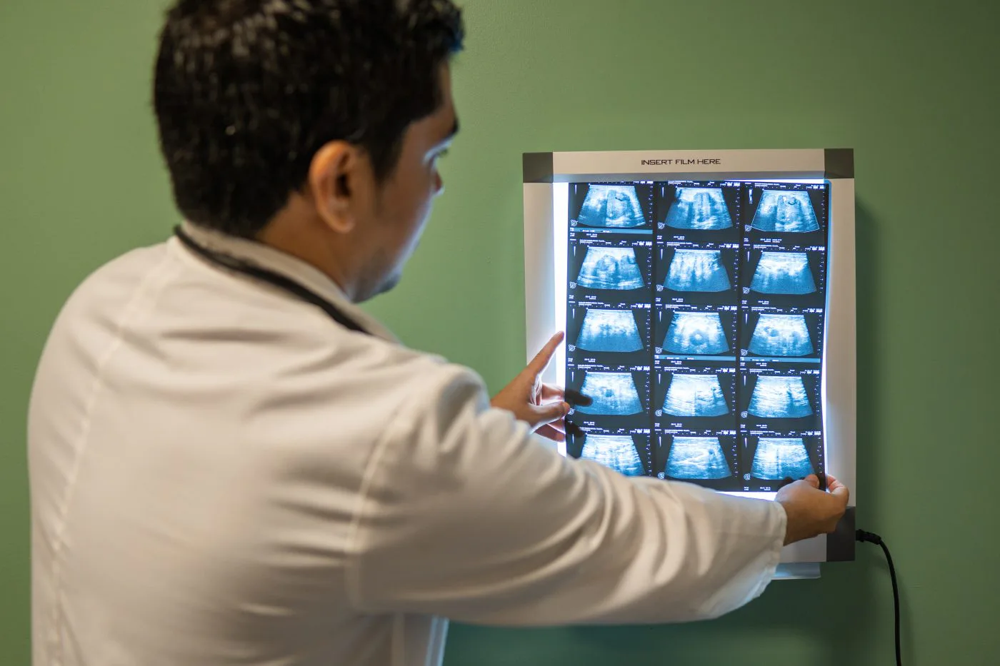 Immunity Therapy Center™-4