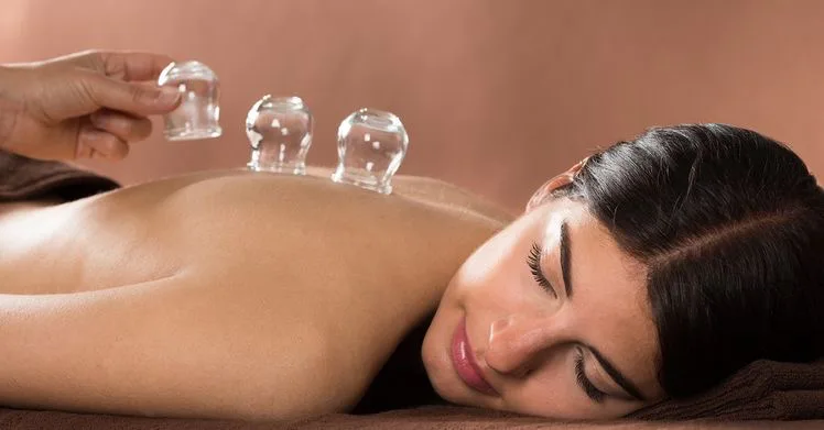 Cupping Therapy