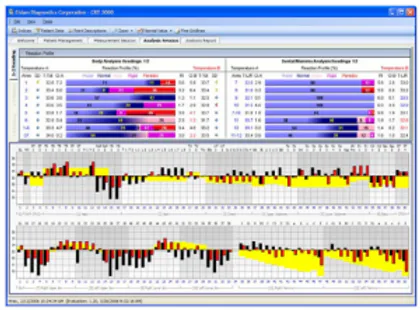 Bioresonance Therapy