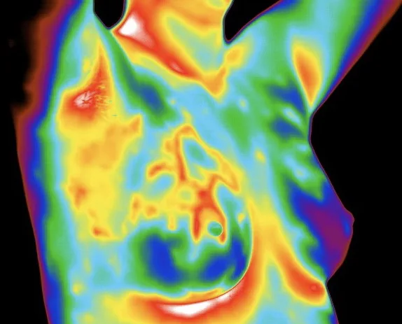 Infrared Thermography