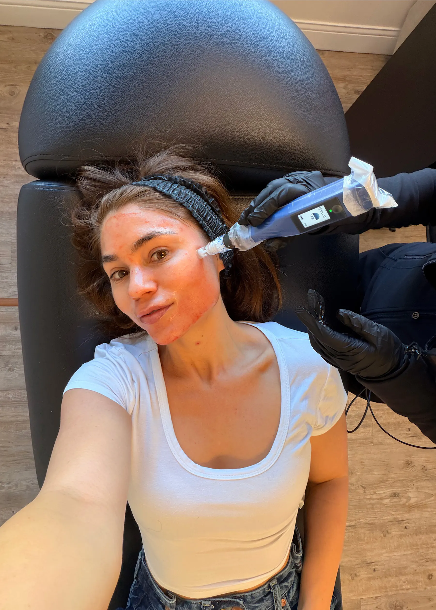 Is NakedMD Med Spa Too Cheap to Be True? Honest Botox, Filler, and Microneedling Review 