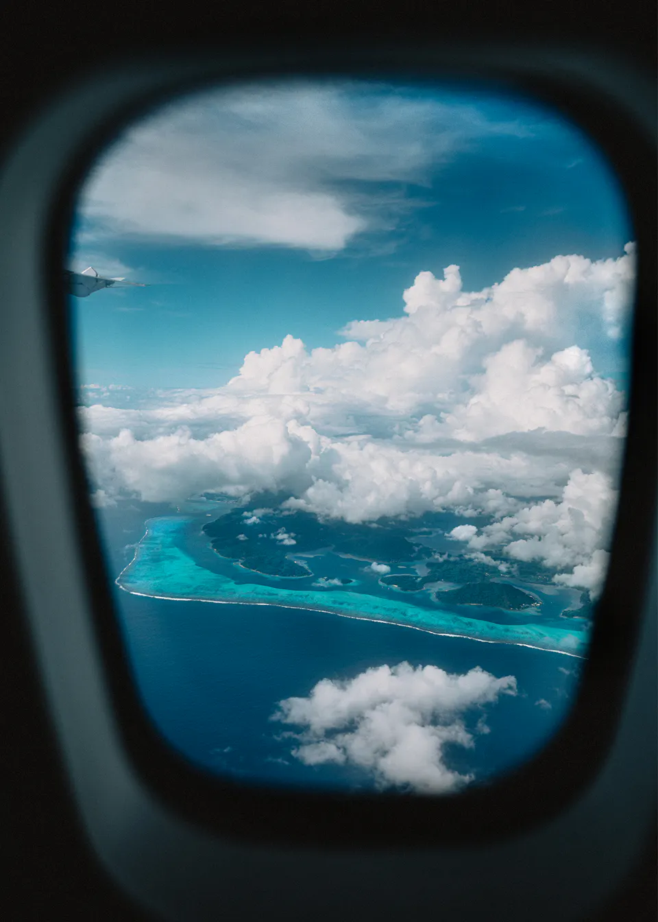 Best Countries to Travel to for a Hair Transplant (2026 Guide)