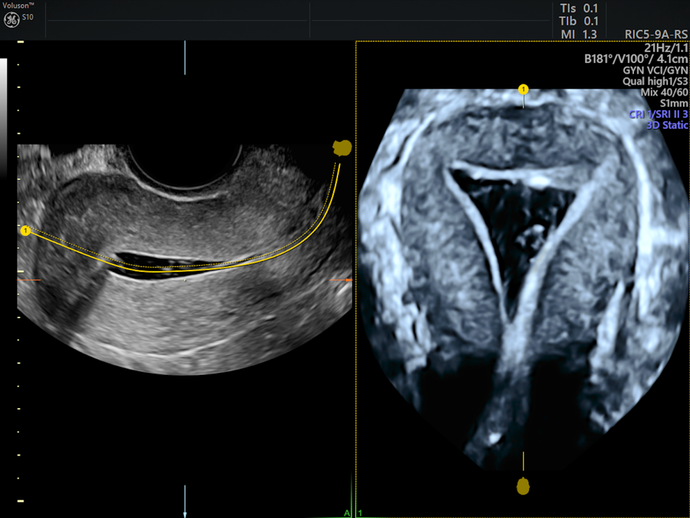 Does Insurance Cover IVF? It Depends... Empowered Women's Health