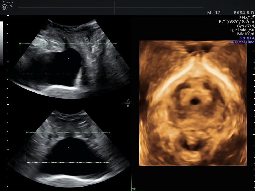 The Role of Ultrasound in UTI Diagnosis & Treatment Empowered Women's