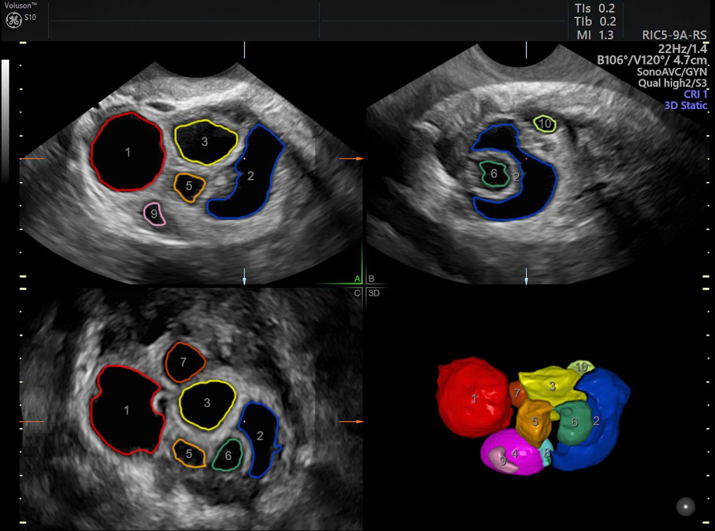 Does Insurance Cover IVF? It Depends... Empowered Women's Health