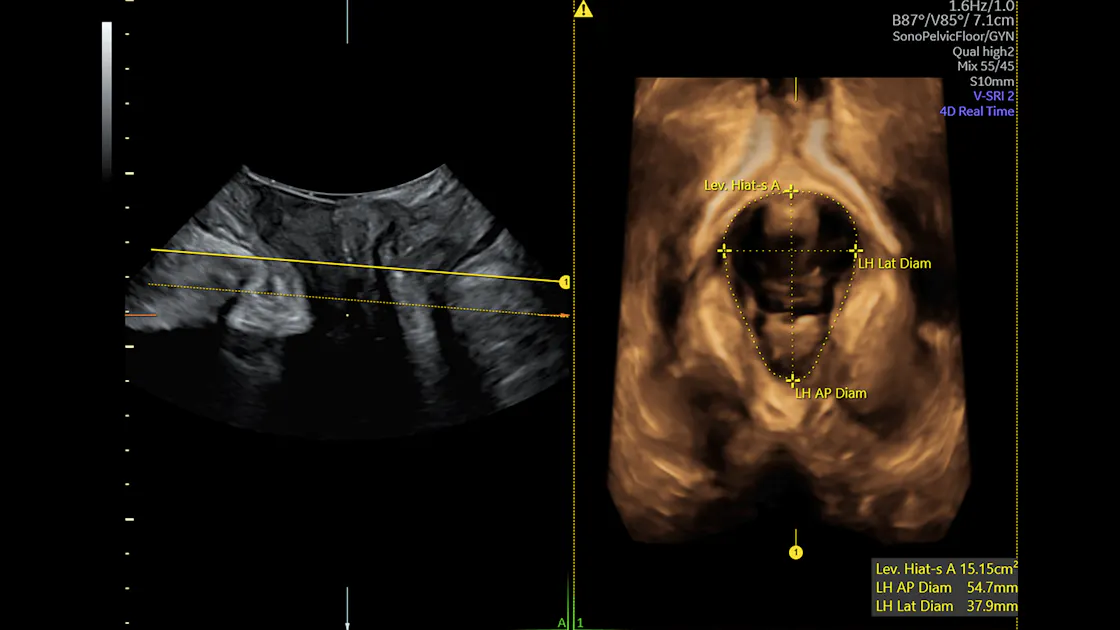 Advanced Urogynecology Technology in Patient Care Empowered Women's