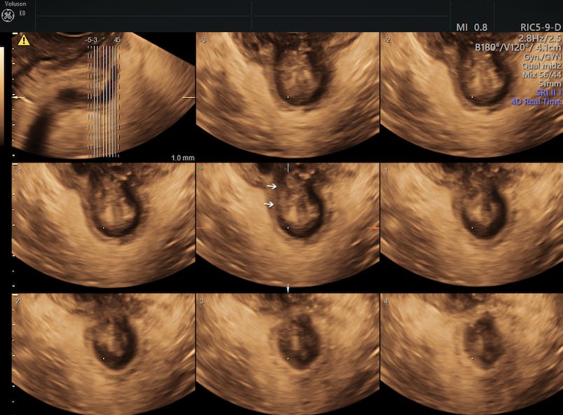 The pelvis  Radiology Key