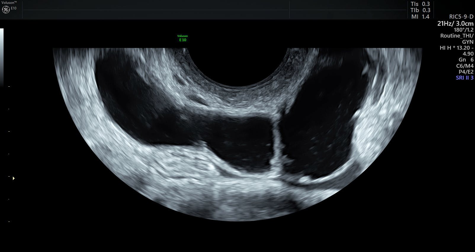 PID Prevention What Your Patients Need To Know Empowered Women s Health