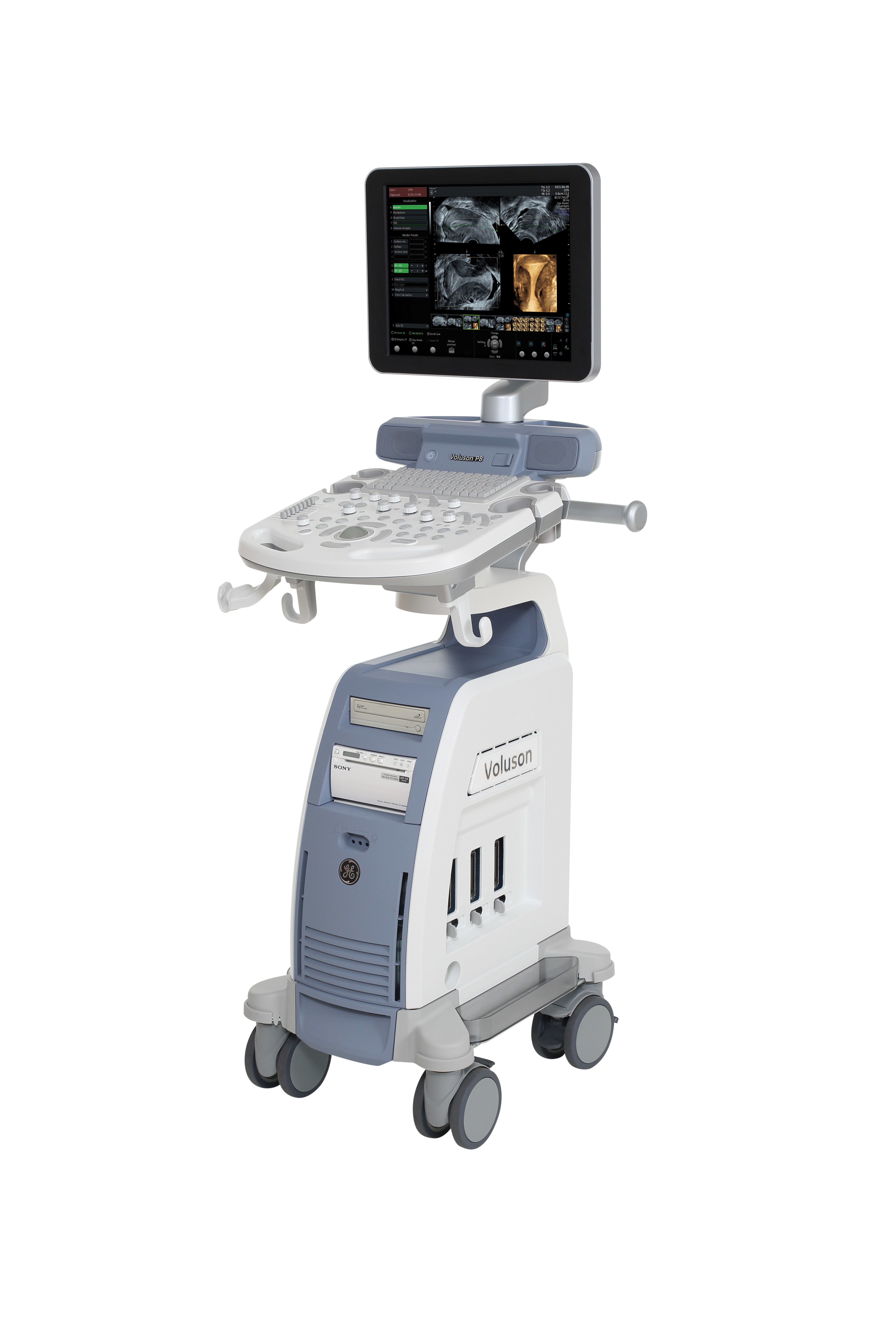 Why Ultrasound Maintenance Is Vital For Patient Safety | Empowered ...