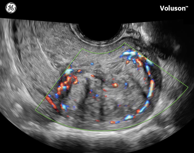 The Onset of Menopause Is Age a Factor? Empowered Women's Health