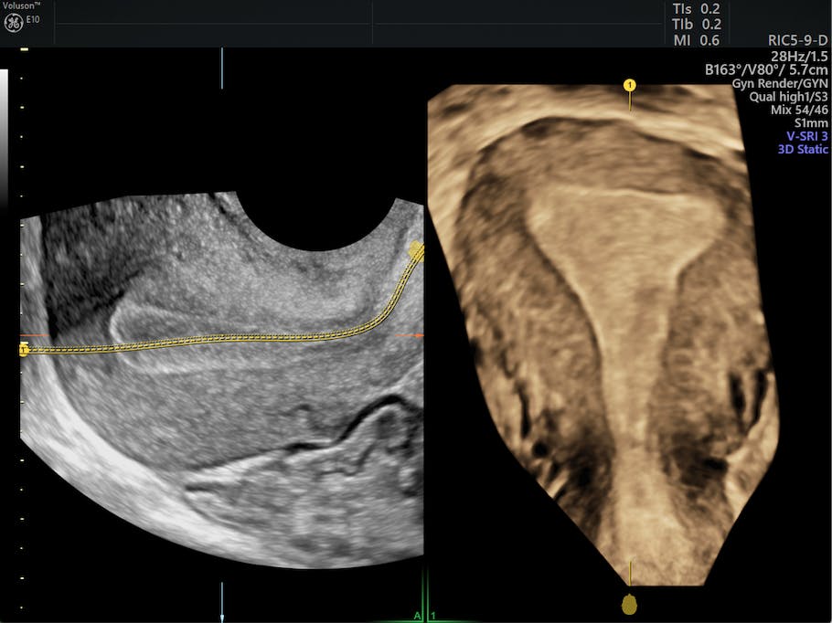 How to Explain the Female Infertility Workup to Patients | Empowered