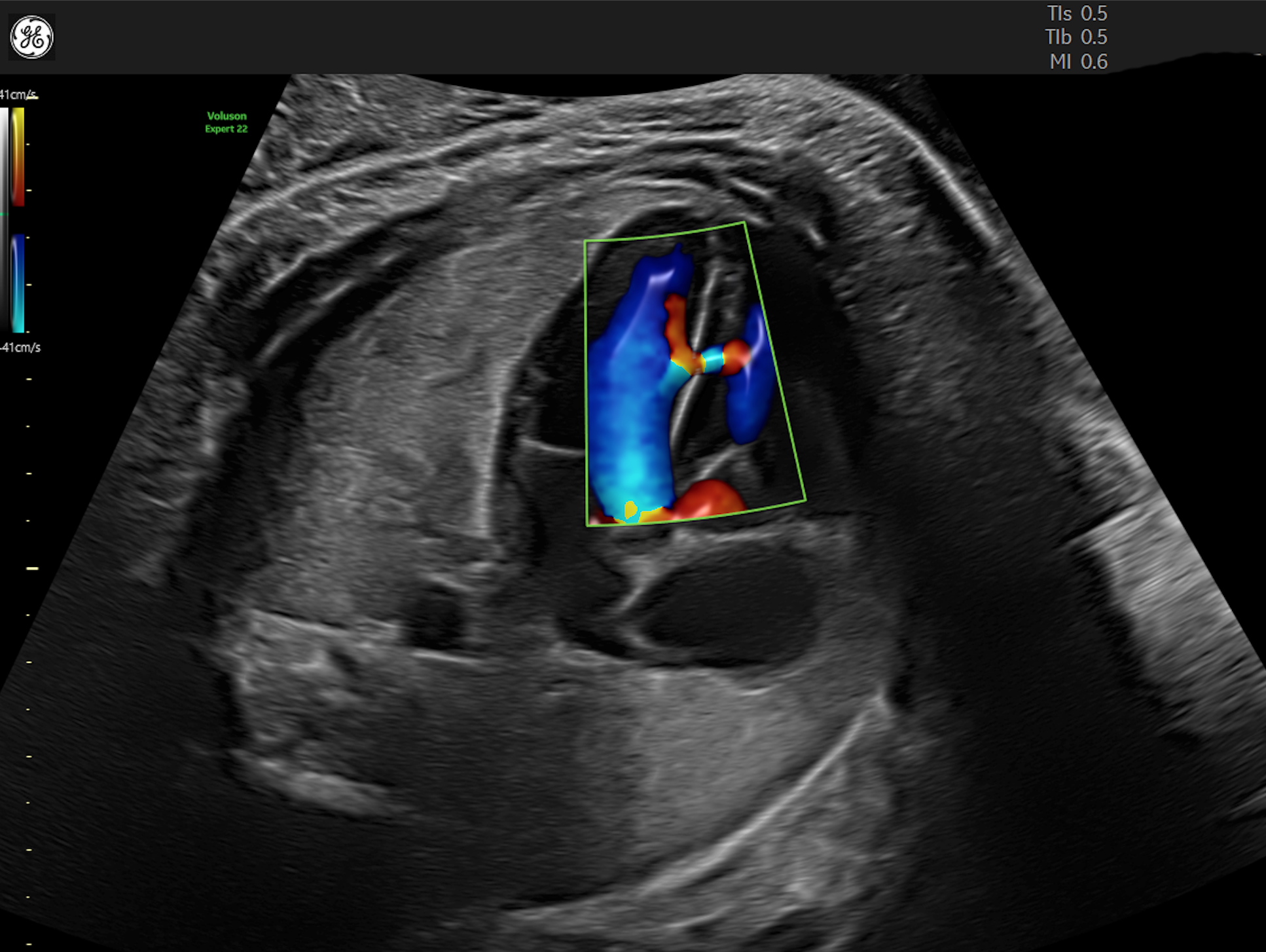 Changing Lives With Prenatal Ultrasound Following Dr. Balu Empowered