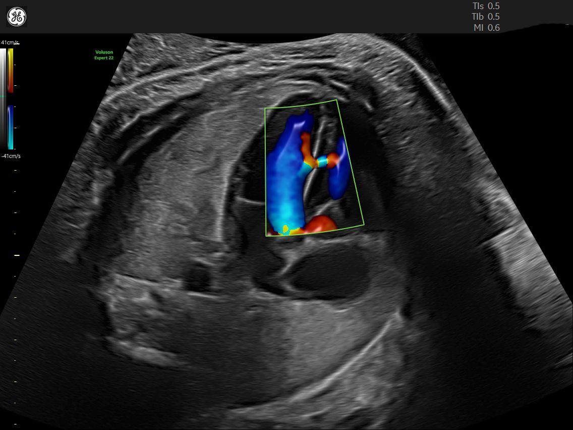 A Short History of the FirstTrimester Ultrasound Empowered Women's