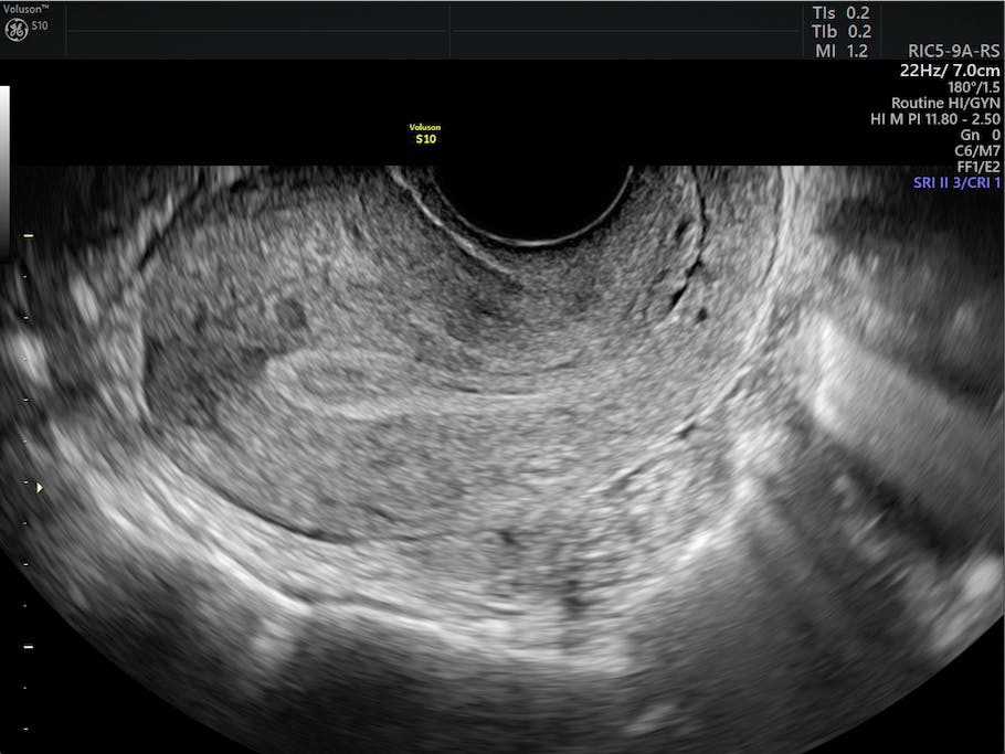 How To Explain The Female Infertility Workup To Patients 