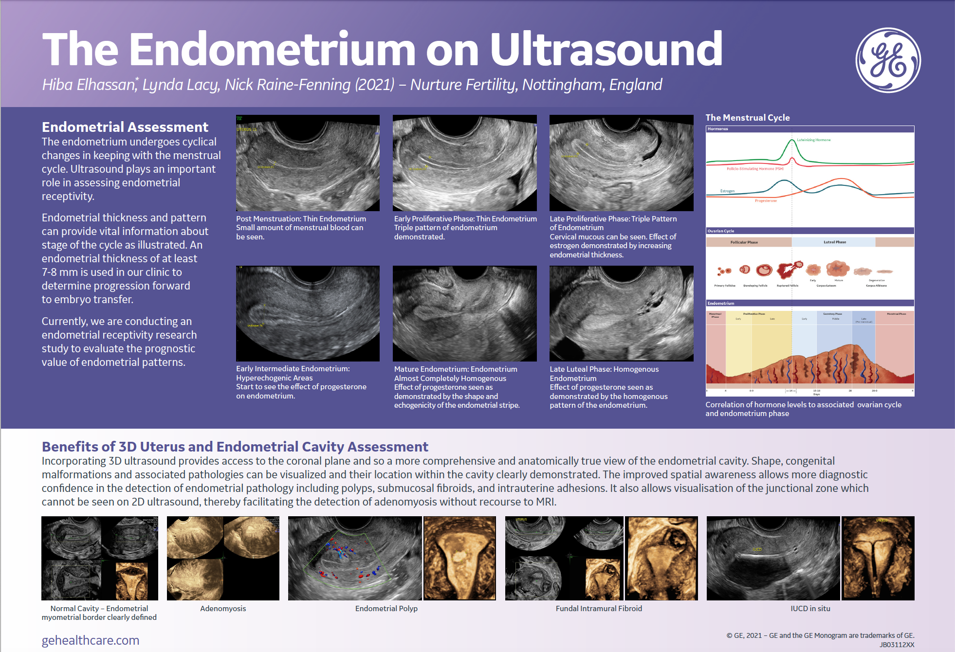 How Ultrasound Can Aid Preliminary Infertility Assessments Empowered