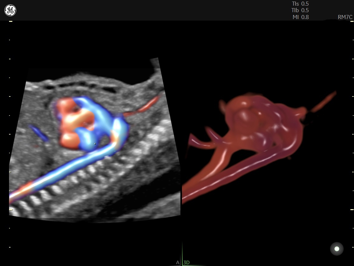 Fetal Heart Monitoring  Johns Hopkins Medicine