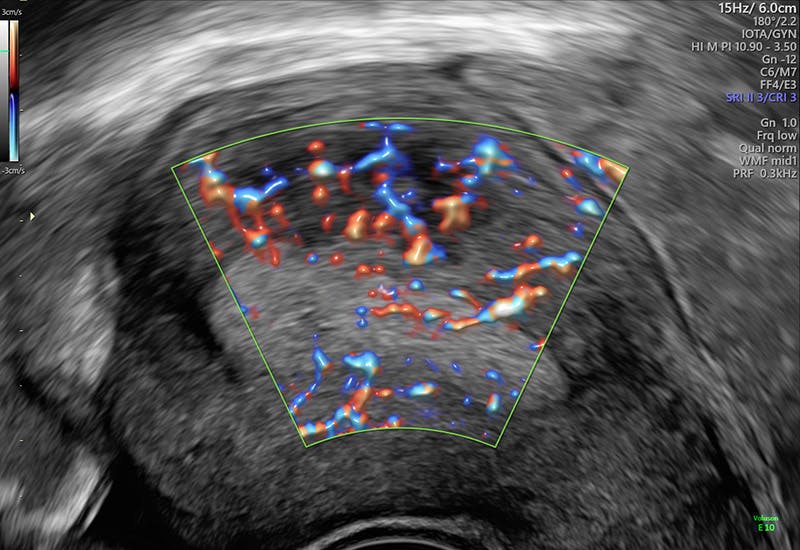 Fertility Ultrasound Scan Empowered Womens Health 9772