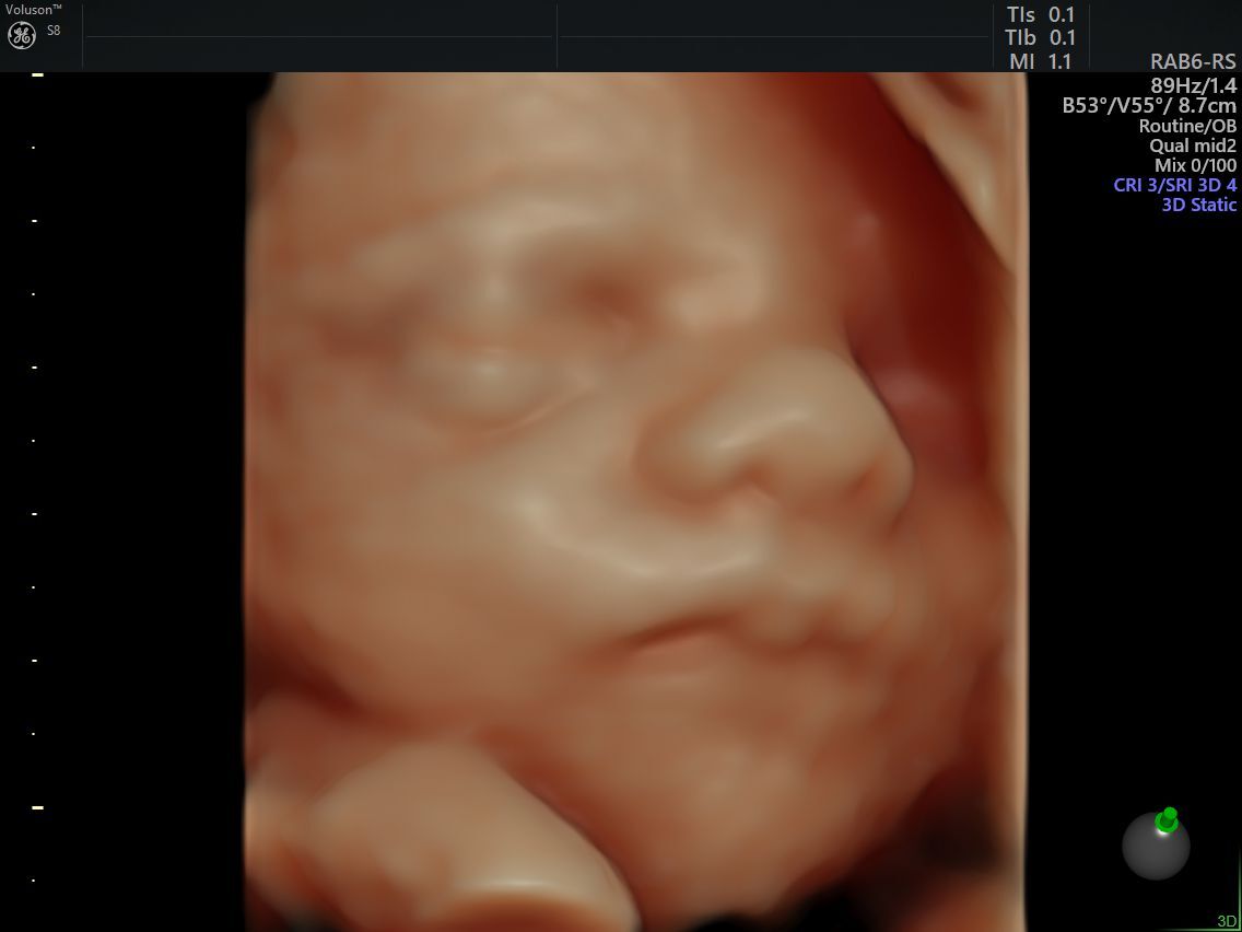 A Short History of the FirstTrimester Ultrasound Empowered Women's