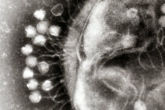 Transmission electron micrograph of multiple bacteriophages attached to a bacterial cell wall; the magnification is approximately 200,000X