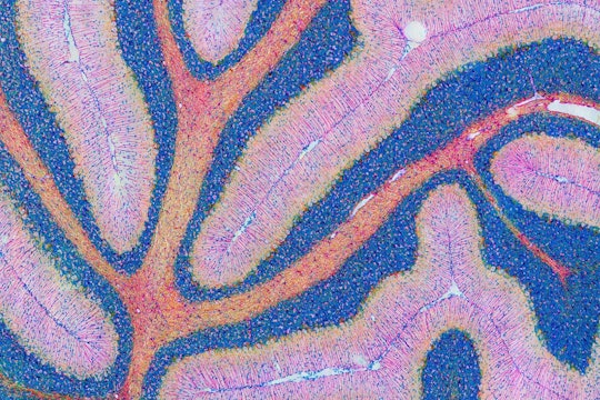 An image of a mouse cerebellum stained pink and blue