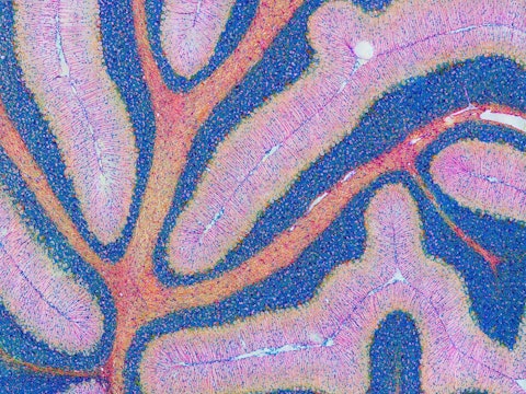 An image of a mouse cerebellum stained pink and blue