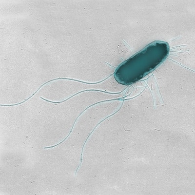 E. coli with tail-like flagella