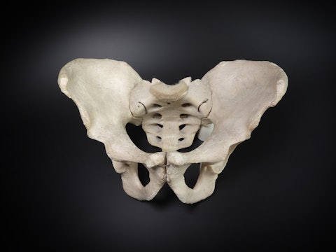 How the pelvis, and not bipedalism, gave humans their narrow hips