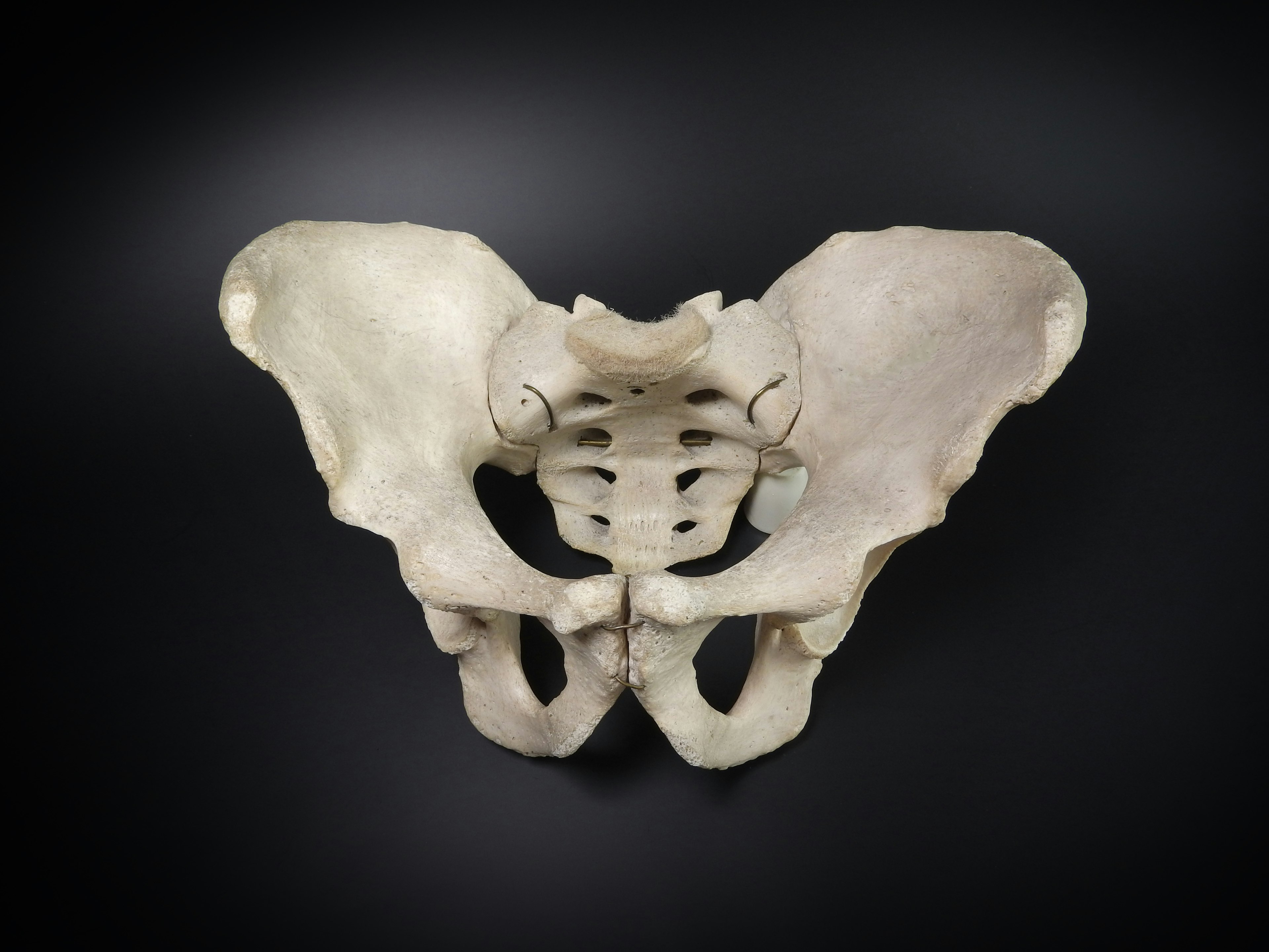 A human pelvis