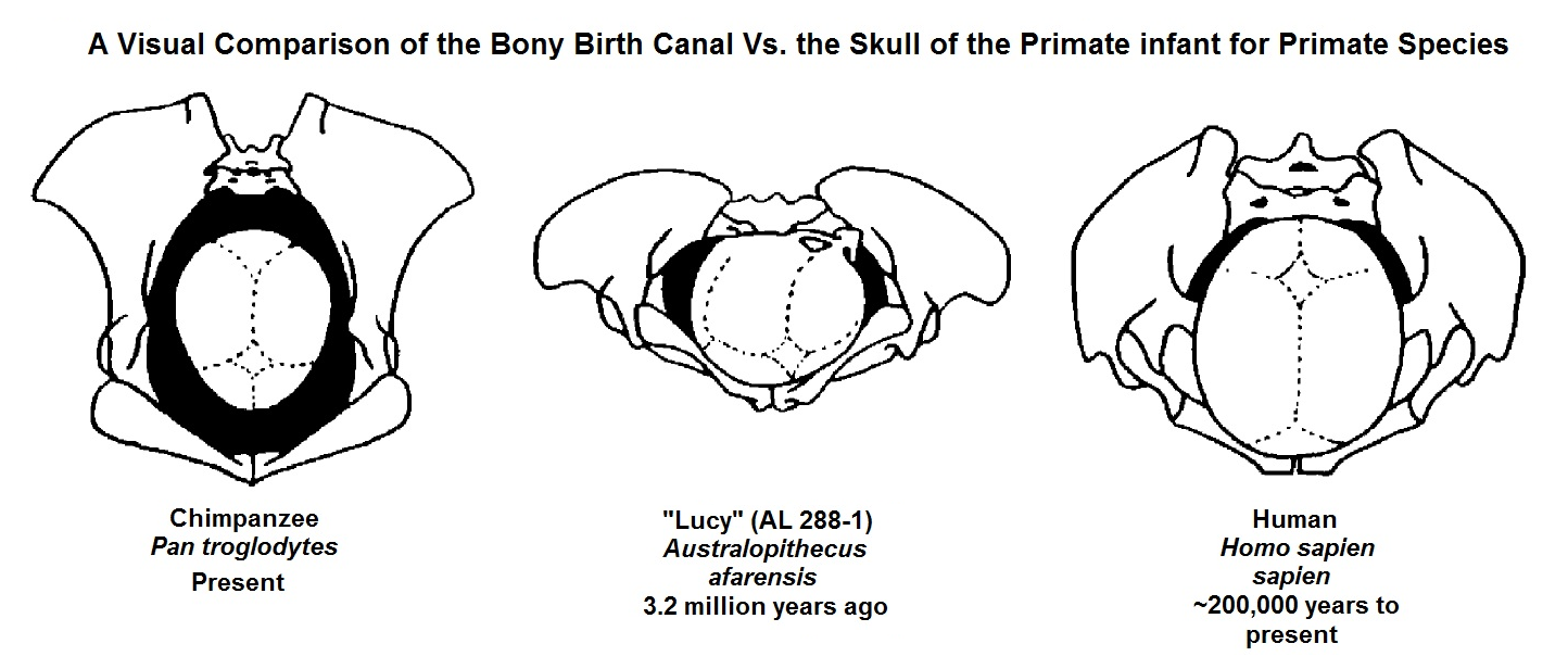 Human infants have much larger skulls, and must pass through a much narrower pelvis, than other apes or hominids.  