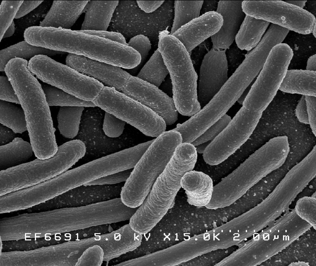 E. coli micrograph