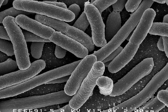 E. coli micrograph