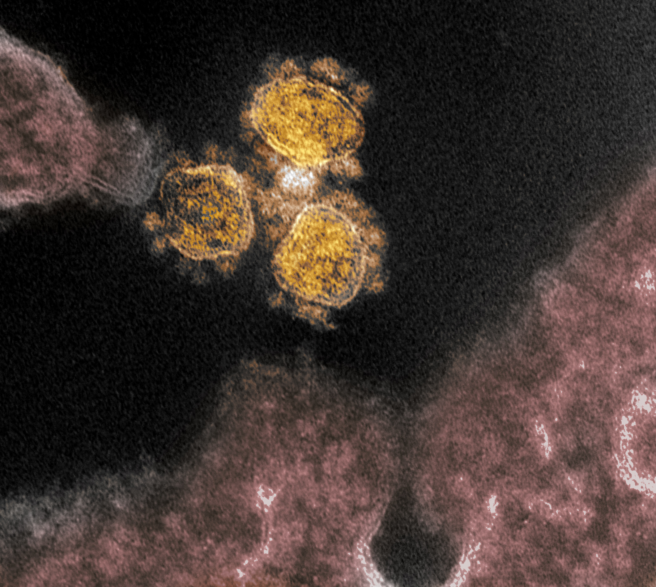 Coronavirus particles (round gold objects) are shown emerging from the surface of cells cultured in the lab. 