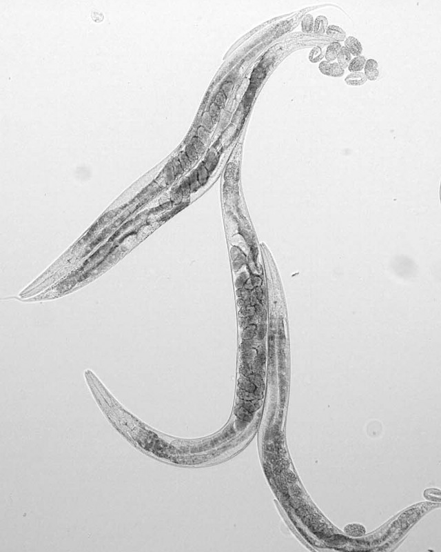 C. elegans under a microscope