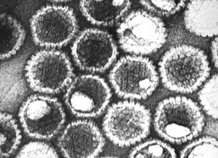 Transmission Electron Micrograph of HSV-1 