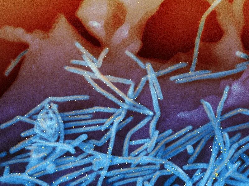 electron micrograph of human RSV virus, long thin blue rods against a red background