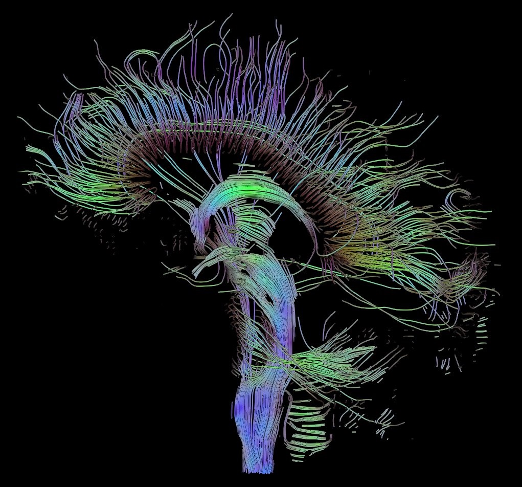 Visualization of a DTI measurement of a human brain, showing the pathway taken by different neural fibers.
