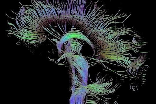 Visualization of a DTI measurement of a human brain, showing the pathway taken by different neural fibers.
