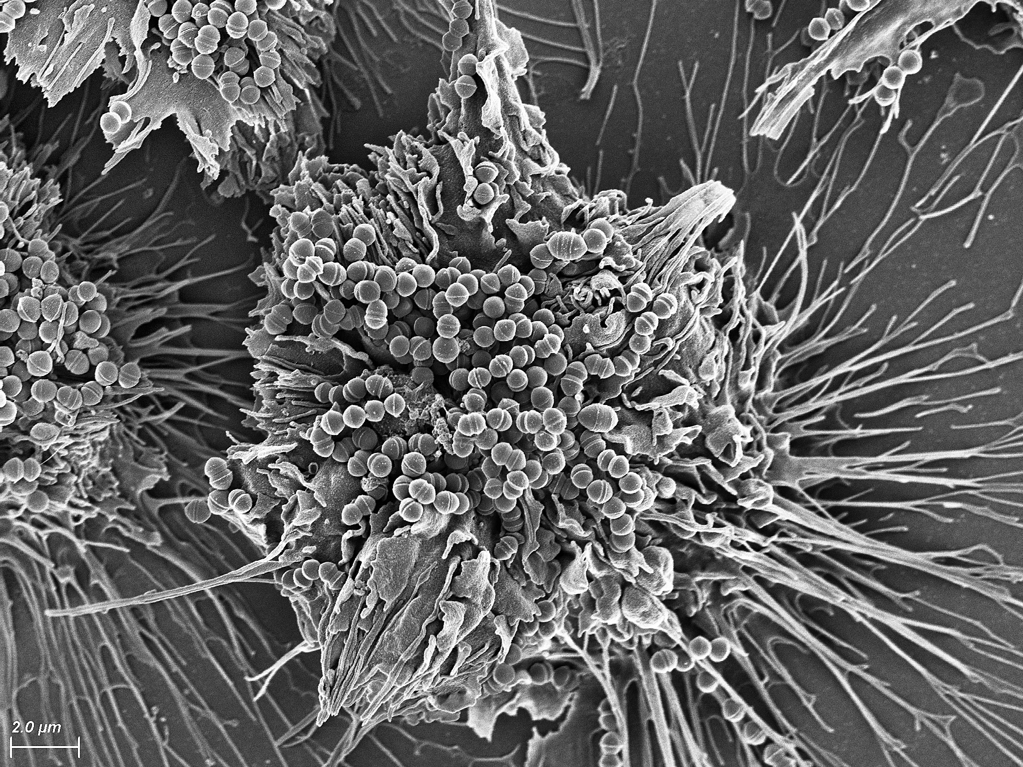 A modern electron micrograph of streptococcus bacteria. 