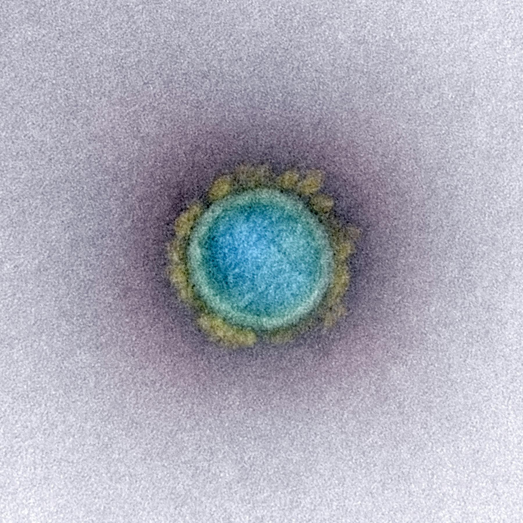 The SARS-CoV-2 virus. A virus-like particle mimics the outside envelope but does not contain the genome within