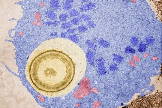 blue cell that has enveloped a tan cell