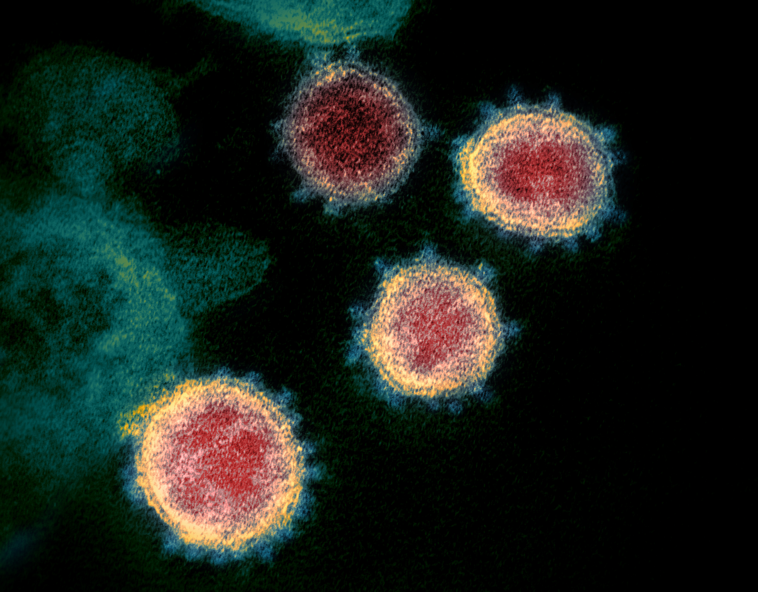 Transmission electron microscope image of SARS-COV-2 virus