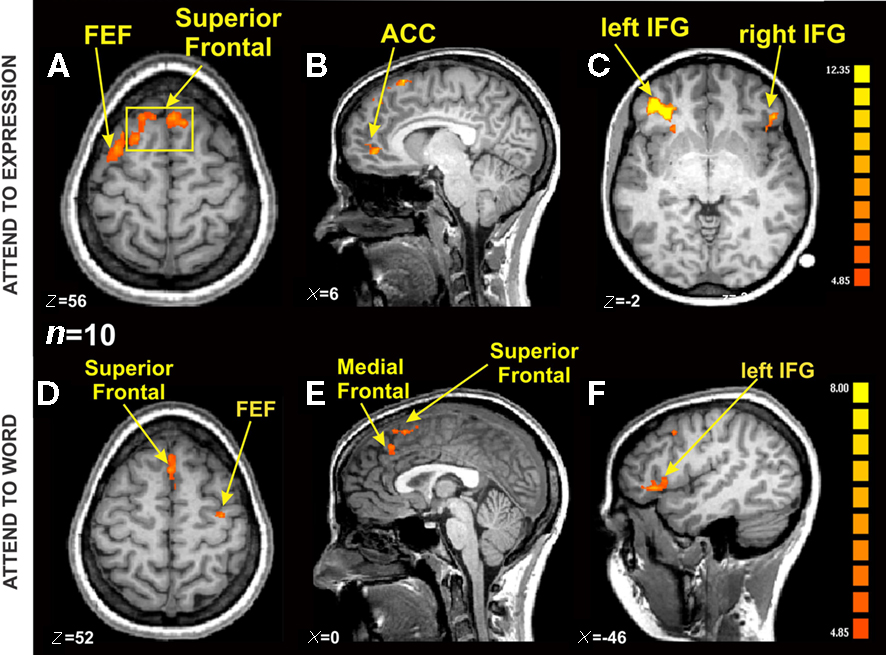 A diagram of fMRI brain scans showing BOLD activation