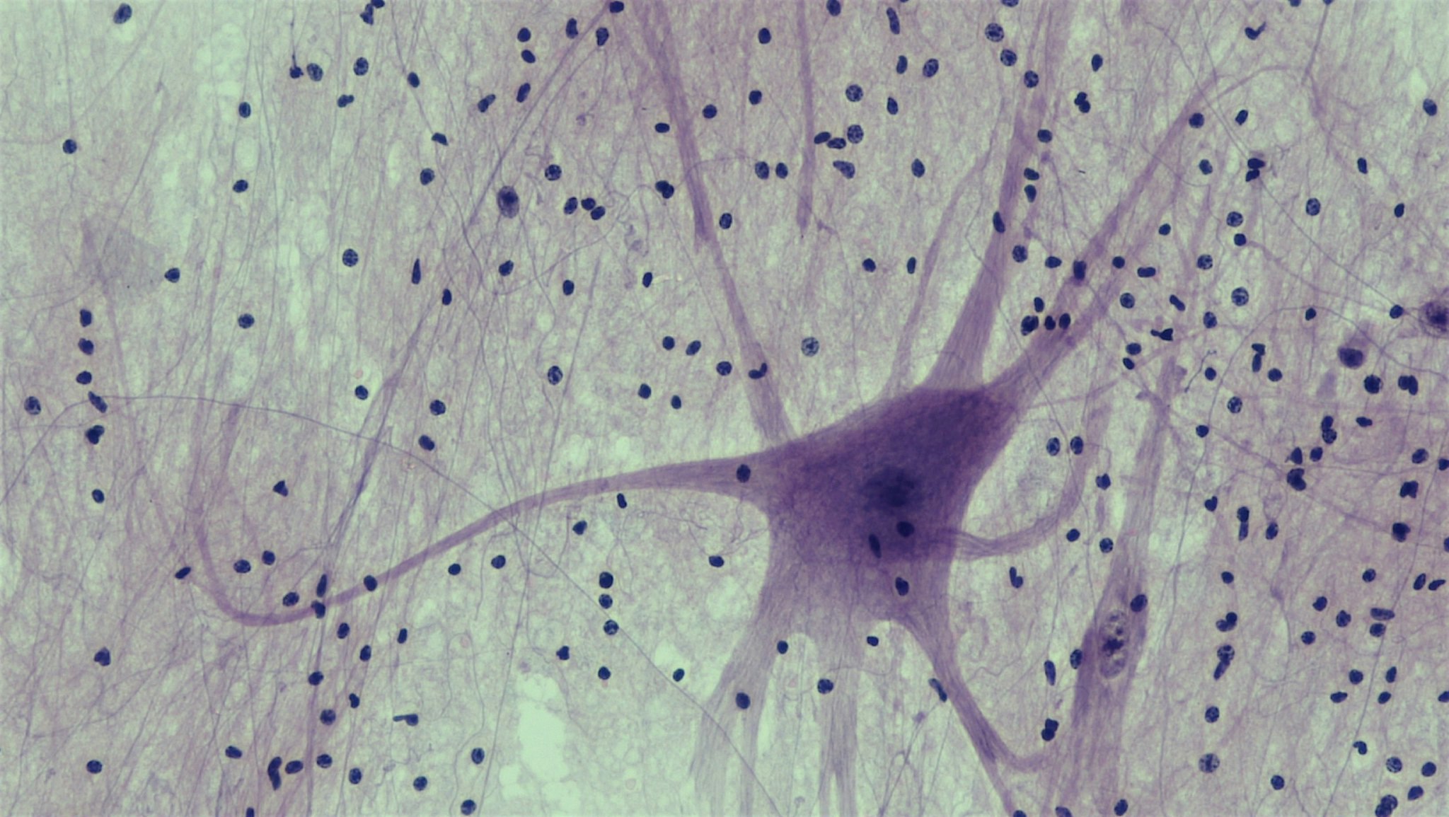 Spinal cord motor neuron