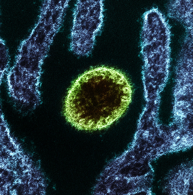 bright green virus particle under microscope