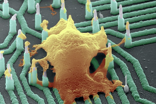 A neuron hooked up to a nanowire array, to read the neuron's electrical activitiy.