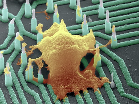 A neuron hooked up to a nanowire array, to read the neuron's electrical activitiy. 
