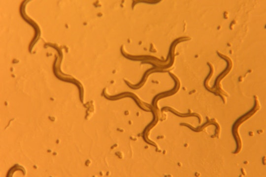small nematode worms under a microscope against an orange background