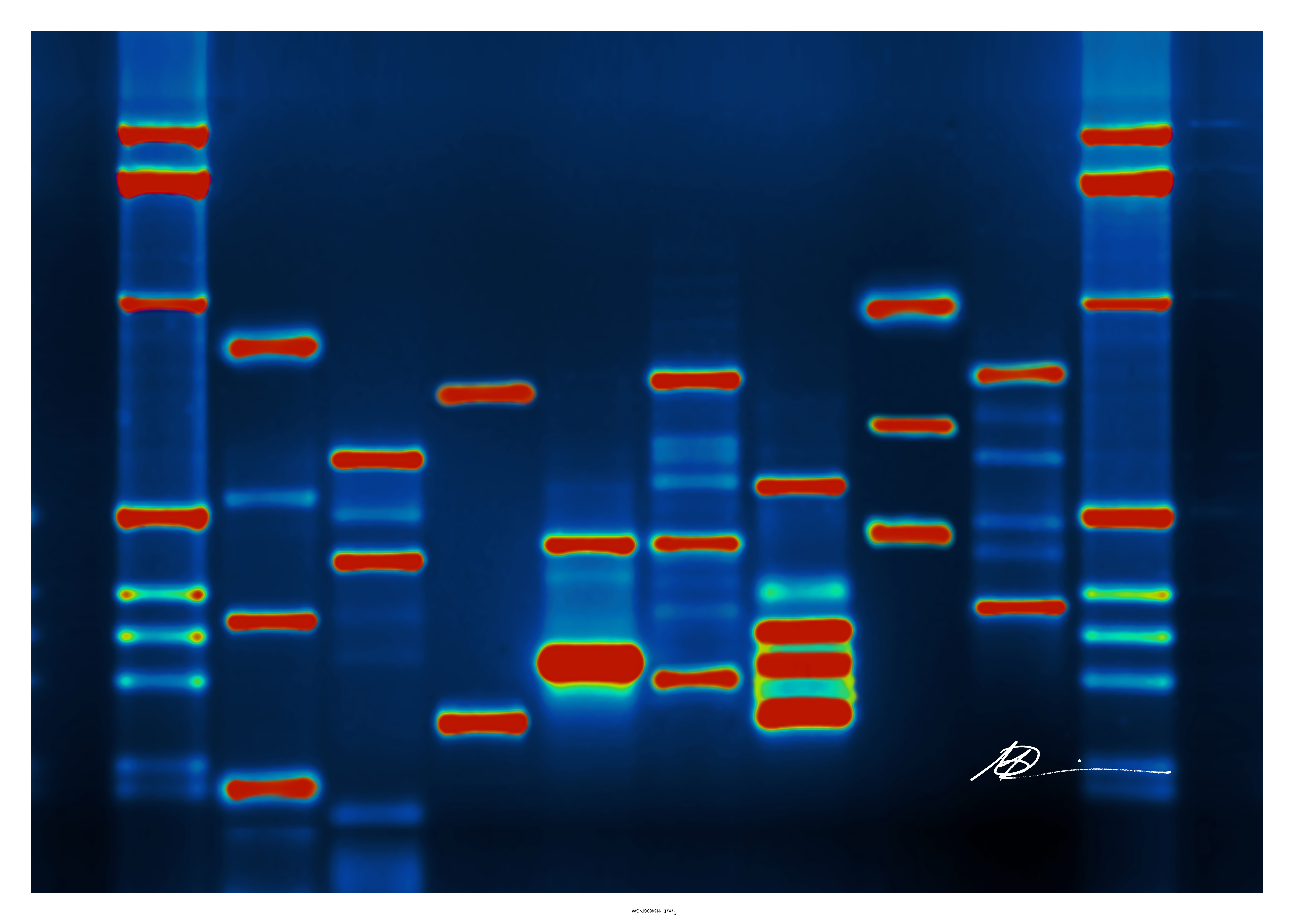 DNA (Southern blot?)