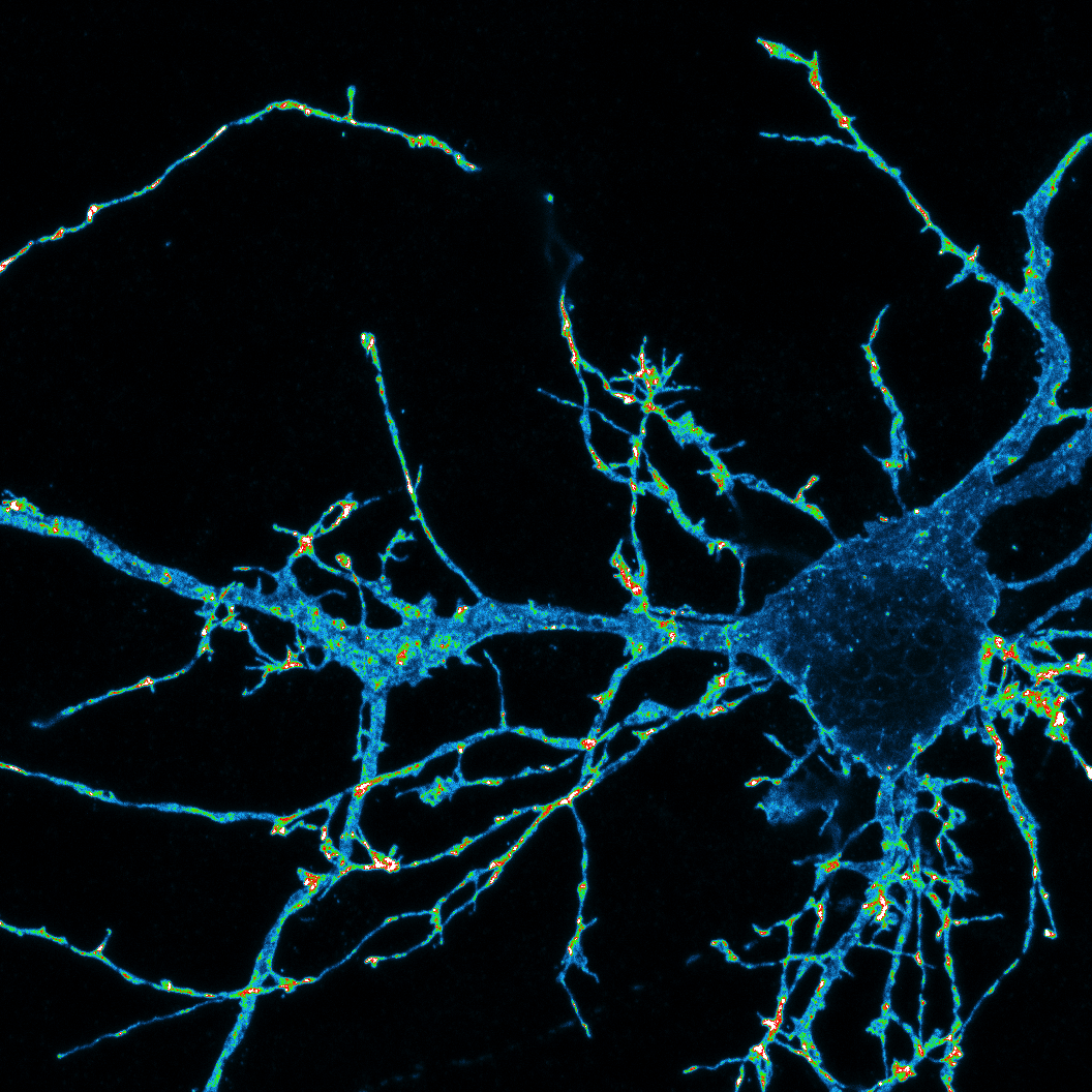 an image of a mouse neuron highlighted in blue and green 