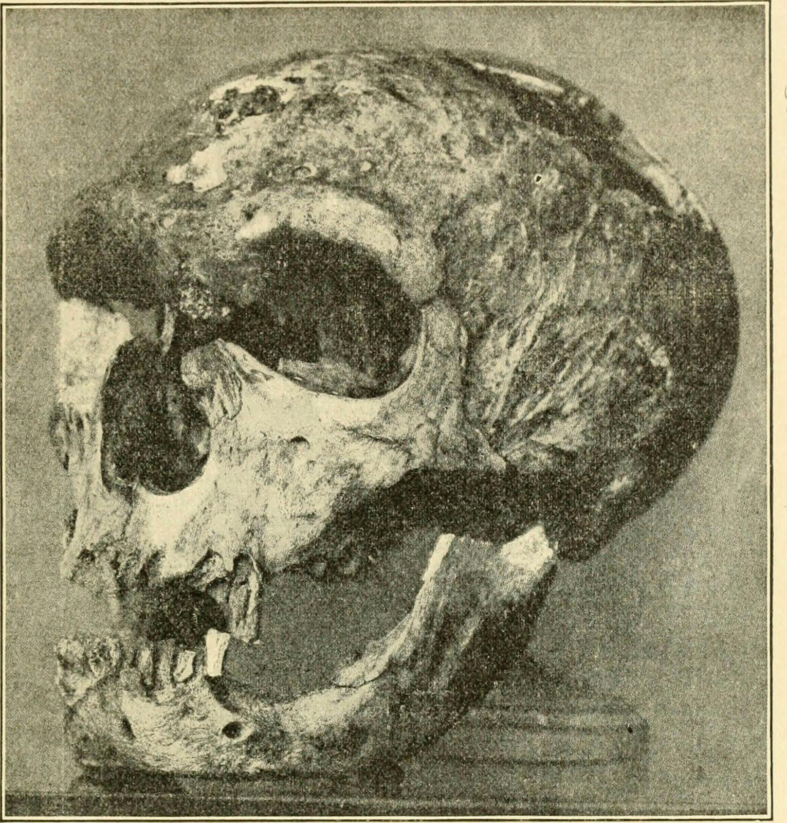 Skull of a Neandertal man.